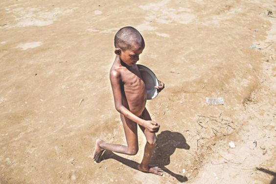 malnutrition